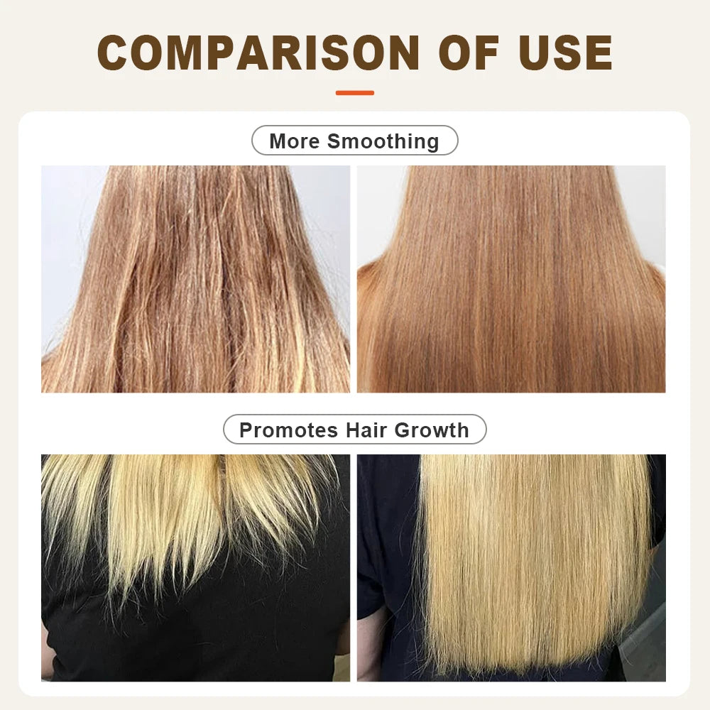 Hair Care Set - Shampoo, Conditioner & Growth Oil for Hair Loss Treatment 600ml