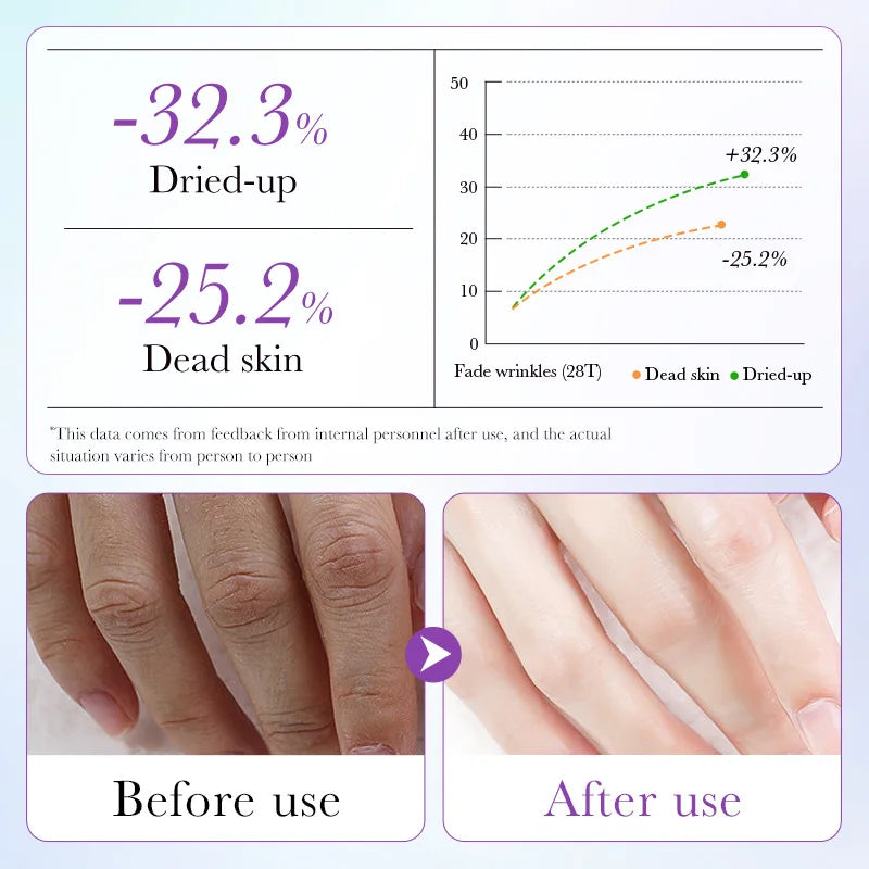 Moisturizing Hand Mask Spa Gloves - Lavender Exfoliating Treatment (5 Pairs)