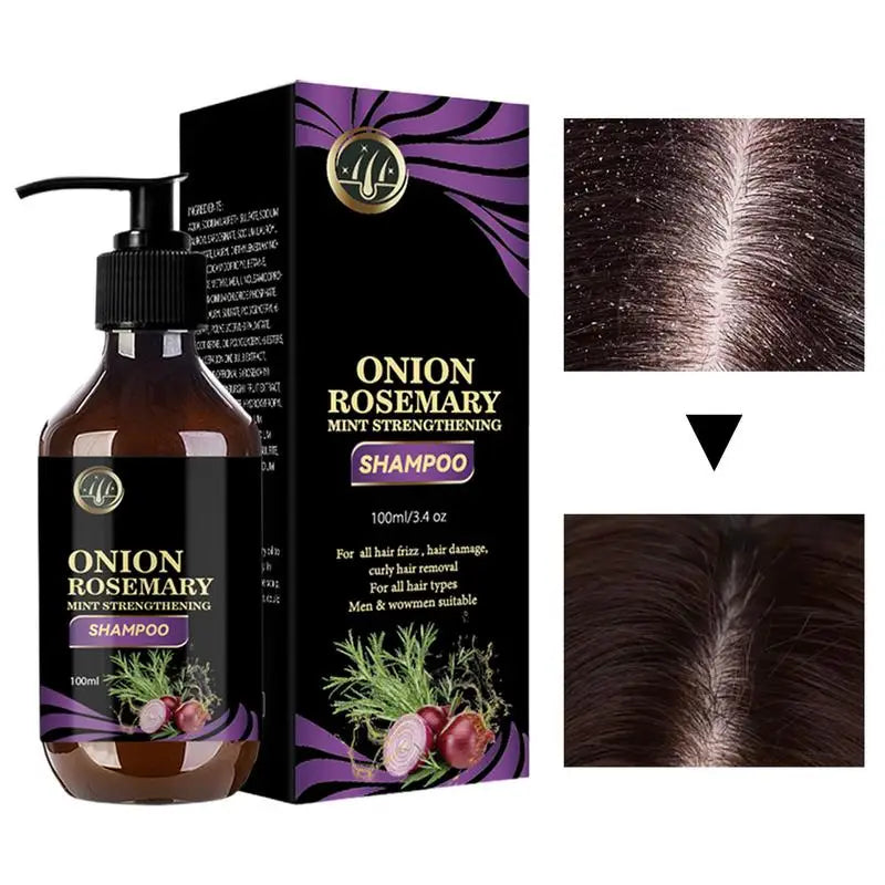 Hair Growth Thickening Shampoo - Rosemary & Onion Deep Cleansing Volumizing Treatment 500ml