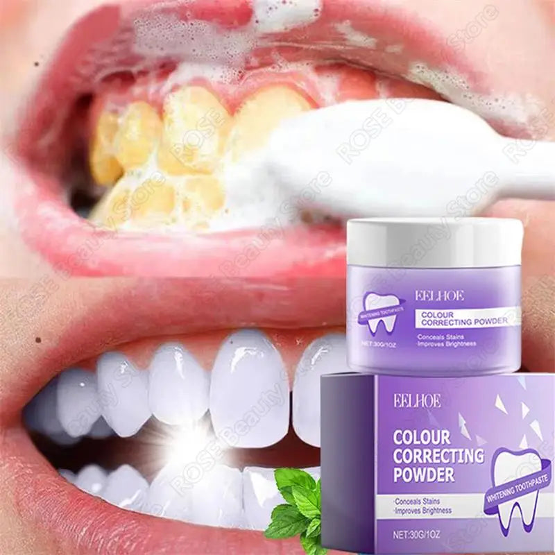 Teeth Whitening Powder - 5-Day Plaque and Stain Remover (30ml)