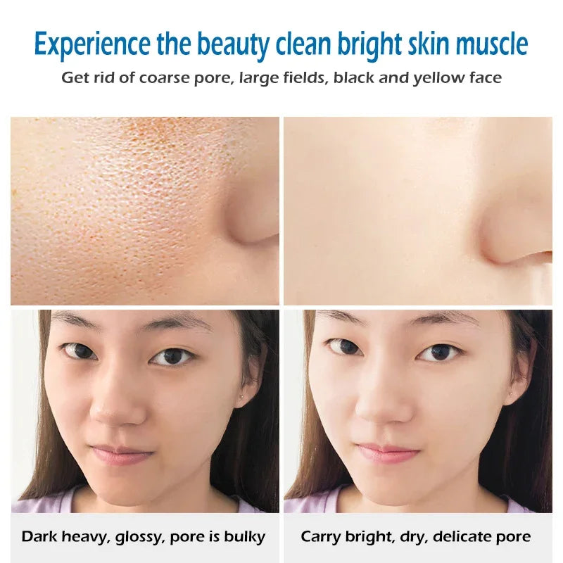 Sea Salt Soap - Whitening and Moisturizing Acne Treatment Bar