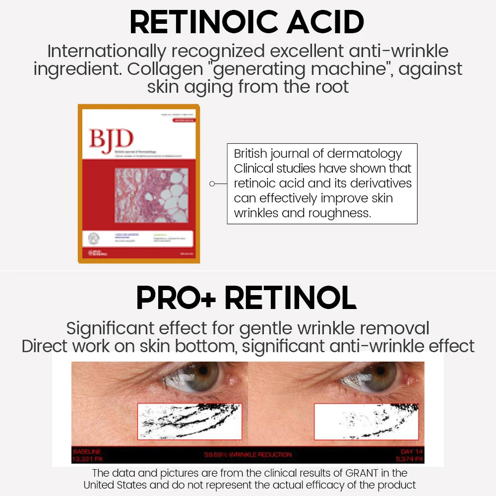 Retinol Face Serum Pro - 3% Retinol Complex for Anti-Aging (30ml)
