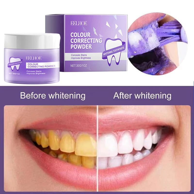 Teeth Whitening Powder - 5-Day Plaque and Stain Remover (30ml)