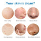 Sea Salt Soap - Whitening and Moisturizing Acne Treatment Bar