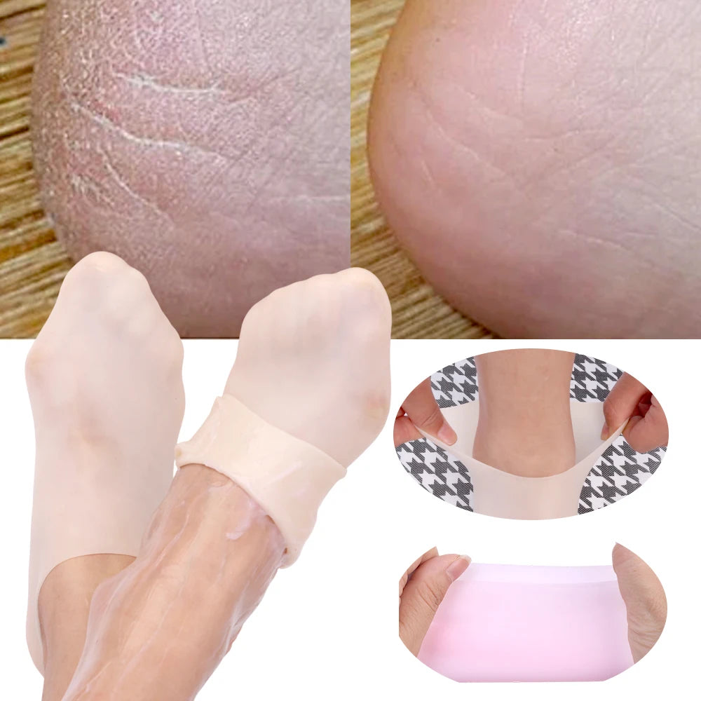 Silicone Moisturizing Gel Foot Socks - Spa Treatment for Dry Cracked Feet