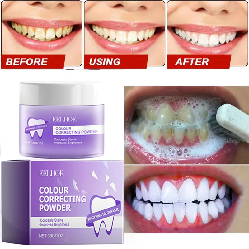 Teeth Whitening Powder - 5-Day Plaque and Stain Remover (30ml)